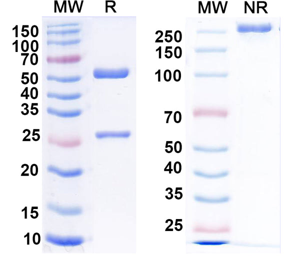 SDS-PAGE for Anti-Clcn1 Antibody (N305/1)