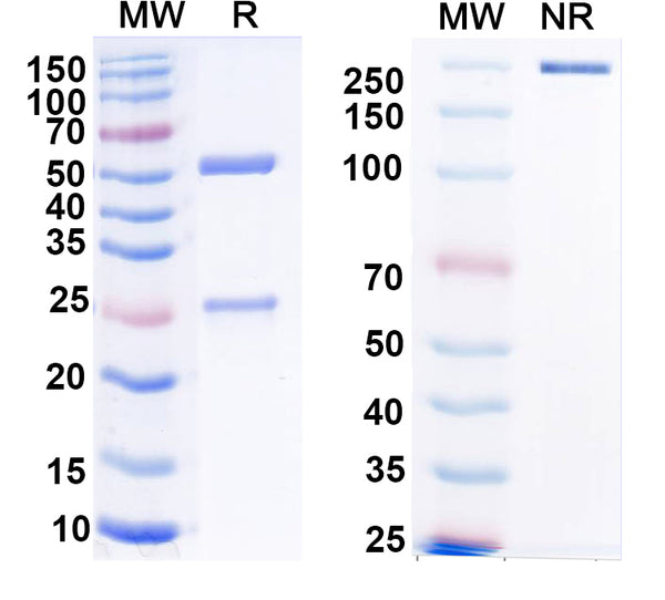 SDS-PAGE for Anti-Clcn1 Antibody (N305/2)