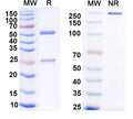 SDS-PAGE for Anti-Clcn1 Antibody (N426/7)