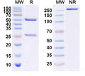 Anti-Human CEACAM-5/CD66e Reference Antibody (Lemalesomab) – Figure 1 of 1