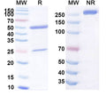 Anti-Human CD66c/CEACAM6 Reference Antibody (NEO-201) – Figure 1 of 1