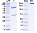 SDS-PAGE for Anti-Human LTBR Antibody (SAA1558)