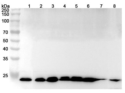Western blot analysis was performed using anti-ARHGDIB polyclonal antibody at 1µg/ml on various samples.
Lane 1: HL-60 cell lysate
Lane 2: Jurkat cell lysate
Lane 3: Raji cell lysate
Lane 4: THP-1 cell lysate
Lane 5: U937 cell lysate
Lane 6: Mouse spleen lysate
Lane 7: Mouse lung lysate
Lane 8: Rat spleen lysate