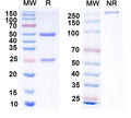 SDS-PAGE for Anti-Clcn7 Antibody (N436/61)