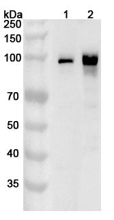 Western blot analysis was performed using anti-CTNNB1 polyclonal antibody at 1ug/mL on various samples.
Lane 1: A431 cell lysate
Lane 2: Lncap cell lysate