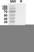 Western blot analysis was performed using anti-PGM1 polyclonal antibody at 1ug/mL on recombinant PGM1 (Catalog No. HW522012).