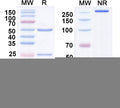 SDS-PAGE for Anti-GRK6A/B Antibody (N142/17)
