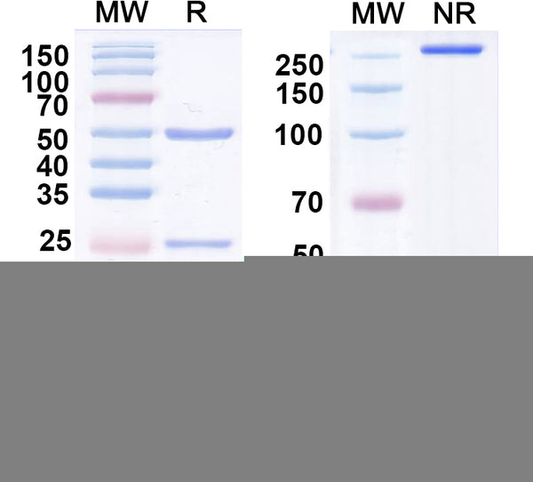 SDS-PAGE for Anti-GRK6A/B Antibody (N142/17)