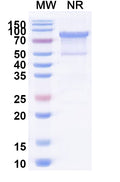 Recombinant Human MRE11 Protein, C-His