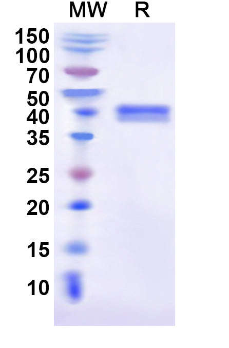 Recombinant Human CD151 Protein, N-GST & C-His