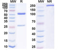 SDS-PAGE for Anti-Human HSPA9/Mortalin/GRP75 Antibody (SAA0812).