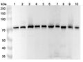 Western blot analysis was performed using anti-Mortalin polyclonal antibody at 1μg/ml on various samples.
Lane 1: Hela cell lysate
Lane 2: K562 cell lysate
Lane 3: A549 cell lysate
Lane 4: MCF-7 cell lysate
Lane 5: HepG2 cell lysate
Lane 6: Mouse liver lysate
Lane 7: Mouse brain lysate
Lane 8: Mouse kidney lysate
Lane 9: Rat liver lysate
Lane 10: Rat brain lysate