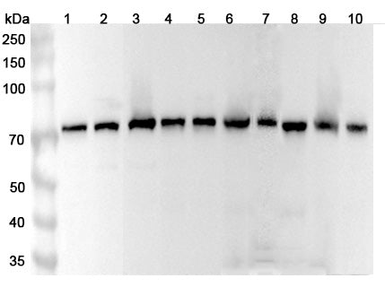 Western blot analysis was performed using anti-Mortalin polyclonal antibody at 1μg/ml on various samples.
Lane 1: Hela cell lysate
Lane 2: K562 cell lysate
Lane 3: A549 cell lysate
Lane 4: MCF-7 cell lysate
Lane 5: HepG2 cell lysate
Lane 6: Mouse liver lysate
Lane 7: Mouse brain lysate
Lane 8: Mouse kidney lysate
Lane 9: Rat liver lysate
Lane 10: Rat brain lysate