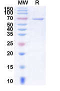 Recombinant Human DSG3 Protein, C-His