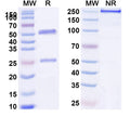 Anti-Human FLT4 Reference Antibody (LY3022856) – Figure 1 of 1