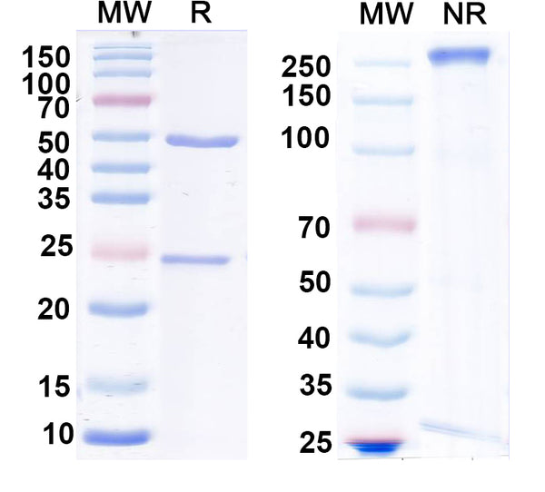 SDS-PAGE for Anti-GluA1/GluR1 glutamate receptor Antibody (N355/1)
