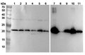 Western blot analysis was performed using anti-UQCRFS1 polyclonal antibody at 1μg/ml on various samples.
Lane 1: MCF7 cell lysate
Lane 2: A2780s cell lysate
Lane 3: Raji cell lysate
Lane 4: A549 cell lysate
Lane 5: MCF7 cell lysate
Lane 6: 293T cell lysate
Lane 7: Mouse heart lysate
Lane 8: Mouse skeletal muscle lysate
Lane 9: Rat brain lysate
Lane 10: Rat heart lysate
Lane11: Rat skeletal muscle lysate