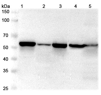 Western blot analysis was performed using anti-LMAN1 polyclonal antibody at 1μg/ml on various samples.
Lane 1: HepG2 cell lysate
Lane 2: MCF7 cell lysate
Lane 3: 293T cell lysate
Lane 4: Mouse heart lysate
Lane 5: Mouse liver lysate