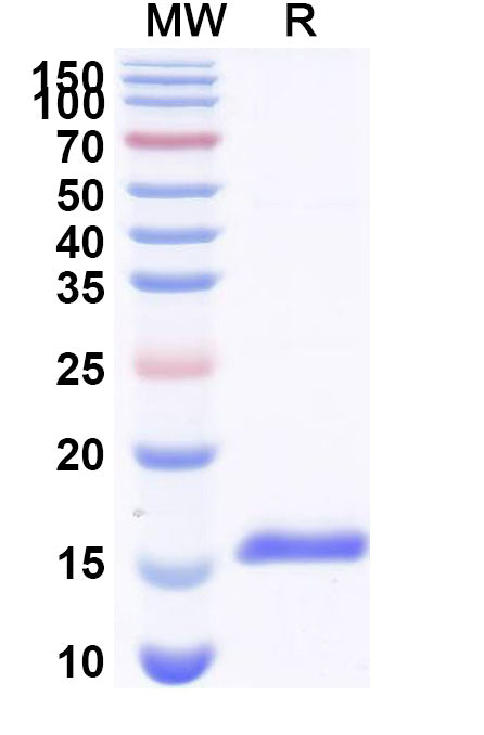 SDS-PAGE for Anti-Human CASR Nanobody (SAA1046)