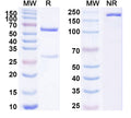 Anti-Human IL-13 Reference Antibody (Zumilokibart) – Figure 1 of 1
