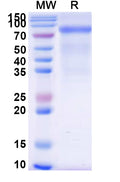 Recombinant Human CD158k/KIR3DL2 Protein, C-Fc