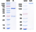 SDS-PAGE for Anti-Copper ATPase 2 (Wilson's disease protein) Antibody (L62/29)