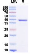 SDS-PAGE for Anti-Human ATP7B Antibody (2R21).