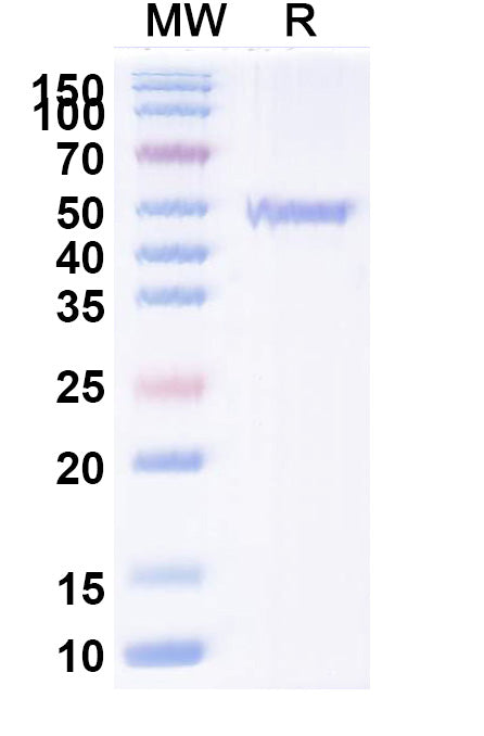 SDS-PAGE for Anti-Human ATP7B Antibody (2R50).