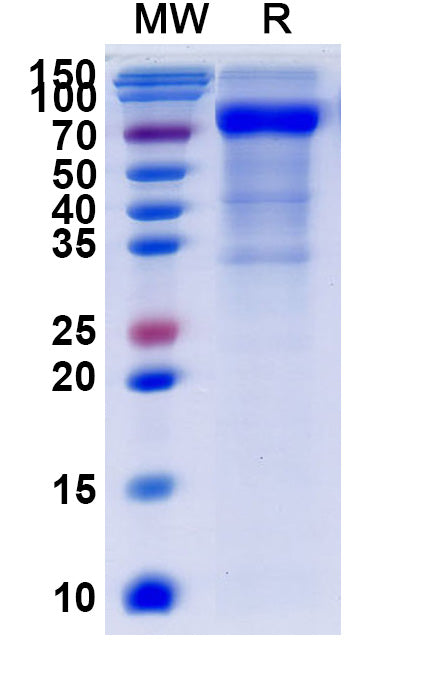 Recombinant Human CD158e/KIR3DL1 Protein, C-Fc