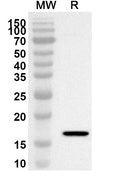 Western blot analysis was performed using anti-HNF1B polyclonal antibody at 1ug/mL on recombinant HNF1B (Catalog No. HW638012).