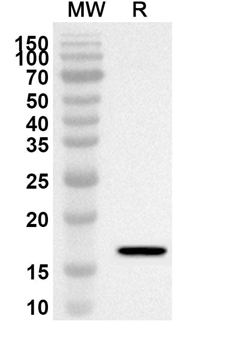 Western blot analysis was performed using anti-HNF1B polyclonal antibody at 1ug/mL on recombinant HNF1B (Catalog No. HW638012).