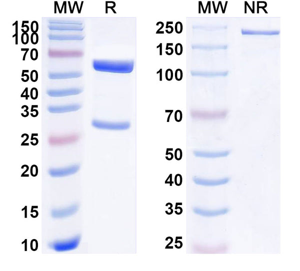 SDS-PAGE for Anti-Human PSEN1/Presenilin-1 Antibody (SAA1782)