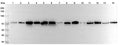 Western blot analysis was performed using anti-HSPA1L polyclonal antibody at 1μg/ml on various samples.
Lane 1: PC12 cell lysate
Lane 2: HepG2 cell lysate
Lane 3: Human plasma lysate
Lane 4: Mouse spleen lysate
Lane 5: Mouse liver lysate
Lane 6: Mouse kidney lysate
Lane 7: Mouse lung lysate
Lane 8: Rat spleen lysate
Lane 9: Rat liver lysate
Lane 10: Rat kidney lysate