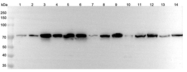 Western blot analysis was performed using anti-HSPA1L polyclonal antibody at 1μg/ml on various samples.
Lane 1: PC12 cell lysate
Lane 2: HepG2 cell lysate
Lane 3: Human plasma lysate
Lane 4: Mouse spleen lysate
Lane 5: Mouse liver lysate
Lane 6: Mouse kidney lysate
Lane 7: Mouse lung lysate
Lane 8: Rat spleen lysate
Lane 9: Rat liver lysate
Lane 10: Rat kidney lysate