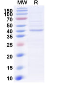 Recombinant Human TDO2 Protein, N-His