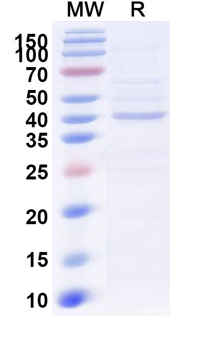 Recombinant Human TDO2 Protein, N-His