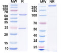 SDS-PAGE for Anti-GluA2/GluR2 glutamate receptor Antibody (L21/14)