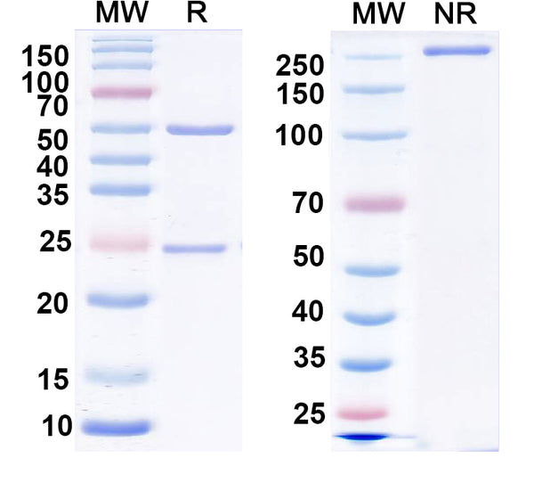 SDS-PAGE for Anti-GluA2/GluR2 glutamate receptor Antibody (L21/14)