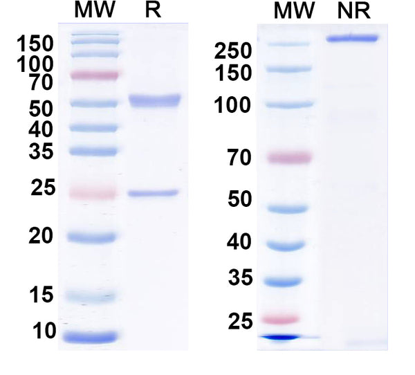 SDS-PAGE for Anti-EAAC1 Antibody (N420/26)