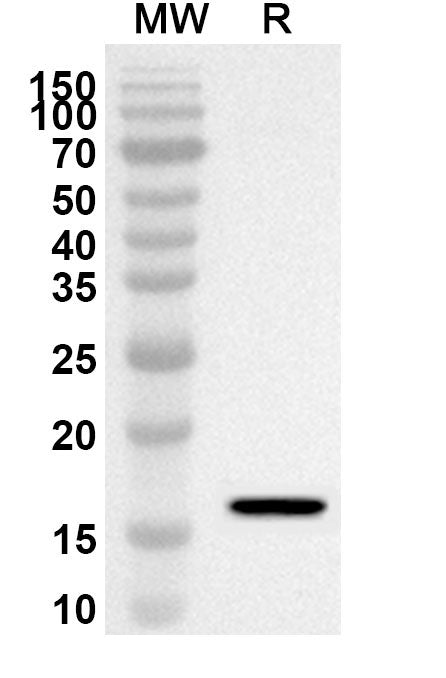 Western blot analysis was performed using anti-ADRA1A polyclonal antibody at 1ug/mL on recombinant ADRA1A (Catalog No. HW676012).