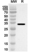 Western blot analysis was performed using anti-PPARG polyclonal antibody at 1ug/mL on recombinant PPARG (Catalog No. HW678012).