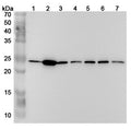 Western blot analysis was performed using anti-PSMB2 polyclonal antibody at 1μg/ml on various samples.
Lane 1: Hela cell lysate
Lane 2: Jurkat cell lysate
Lane 3: 293T cell lysate
Lane 4: MCF-7 cell lysate
Lane 5: K562 cell lysate
Lane 6: HepG2 cell lysate
Lane 7: U937 cell lysate