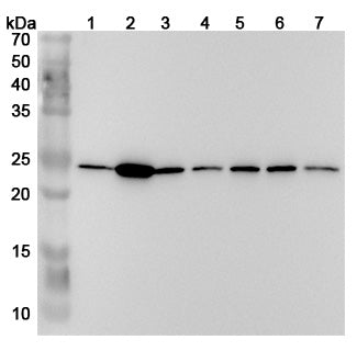 Western blot analysis was performed using anti-PSMB2 polyclonal antibody at 1μg/ml on various samples.
Lane 1: Hela cell lysate
Lane 2: Jurkat cell lysate
Lane 3: 293T cell lysate
Lane 4: MCF-7 cell lysate
Lane 5: K562 cell lysate
Lane 6: HepG2 cell lysate
Lane 7: U937 cell lysate