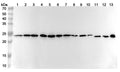 Western blot analysis was performed using anti-ATP5PO polyclonal antibody at 1ug/mL on various samples.
Lane 1: A549 cell lysate
Lane 2: SKOV3 cell lysate
Lane 3: MCF-7 cell lysate
Lane 4: Jurkat cell lysate
Lane 5: HepG2 cell lysate
Lane 6: 293T cell lysate
Lane 7: Hela cell lysate
Lane 8: Mouse brain lysate
Lane 9: Mouse heart lysate
Lane 10: Mouse liver lysate
Lane11: Rat brain lysate
Lane12: Rat heart lysate
Lane13: Rat liver lysate