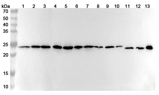 Western blot analysis was performed using anti-ATP5PO polyclonal antibody at 1ug/mL on various samples.
Lane 1: A549 cell lysate
Lane 2: SKOV3 cell lysate
Lane 3: MCF-7 cell lysate
Lane 4: Jurkat cell lysate
Lane 5: HepG2 cell lysate
Lane 6: 293T cell lysate
Lane 7: Hela cell lysate
Lane 8: Mouse brain lysate
Lane 9: Mouse heart lysate
Lane 10: Mouse liver lysate
Lane11: Rat brain lysate
Lane12: Rat heart lysate
Lane13: Rat liver lysate