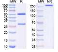 SDS-PAGE for Anti-Human MMP16 Antibody (SAA1573)