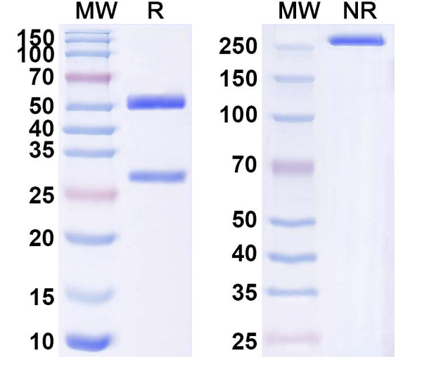 SDS-PAGE for Anti-Human MMP16 Antibody (SAA1573)