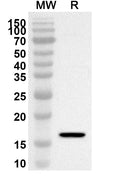 Western blot analysis was performed using anti-GDNF polyclonal antibody at 1ug/mL on recombinant GDNF (Catalog No. HW706012).