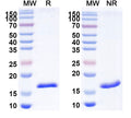 SDS-PAGE for Anti-Human CD70 Nanobody (SAA2049)