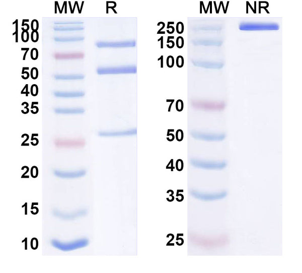 SDS-PAGE for Anti-Human XCR1 Antibody (SAA1638)